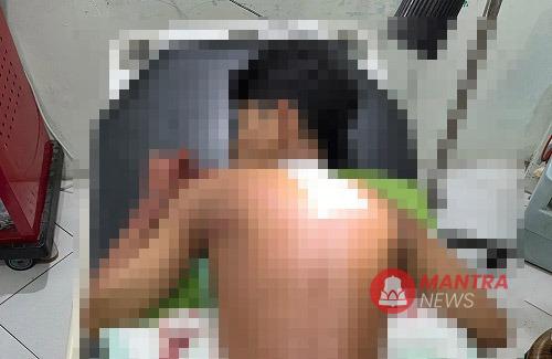 korban pembacokan gangster